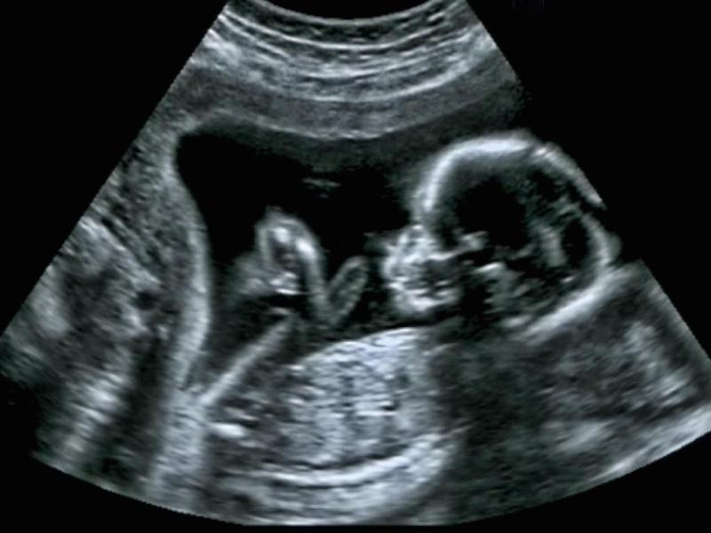 Запис на тонове, стрес, контрол и&nbsp;медитация